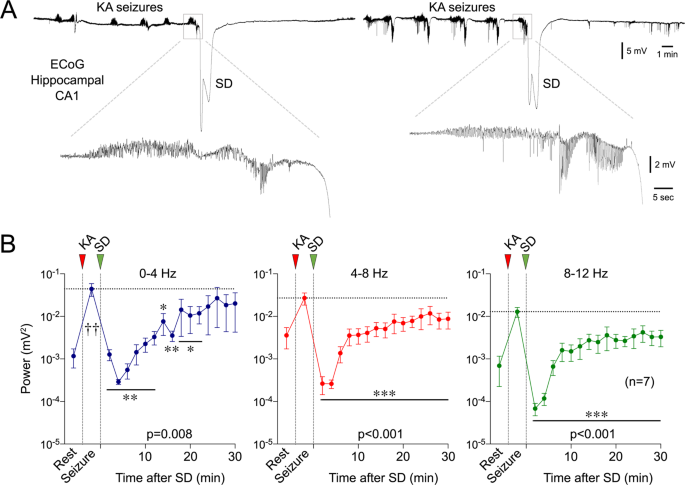Spreading Depression As An Innate Antiseizure Mechanism Nature Communications