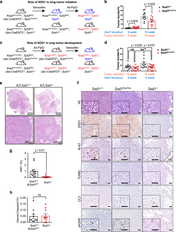 Sod1 Regulates Ribosome Biogenesis In Kras Mutant Non Small Cell Lung Cancer Nature Communications