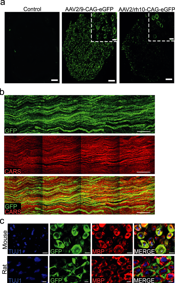 AAV2/9-mediated silencing of PMP22 prevents the development of pathological  features in a rat model of Charcot-Marie-Tooth disease 1 A | Nature  Communications