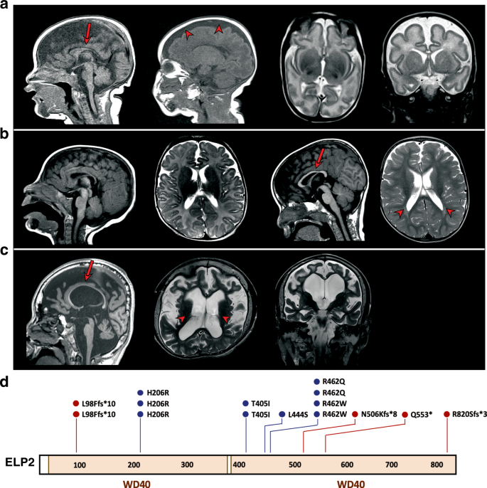 Elp2 Mutations Perturb The Epitranscriptome And Lead To A Complex Neurodevelopmental Phenotype Nature Communications Elp2 Mutations Perturb The Epitranscriptome And Lead To A Complex Neurodevelopmental Phenotype Nature Communications