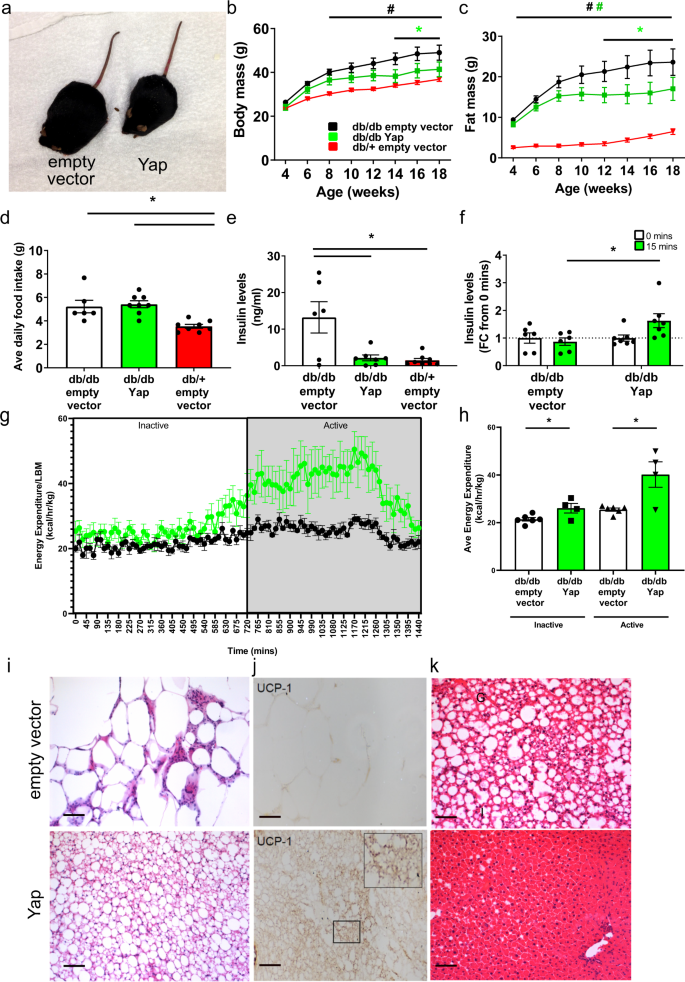 Yap regulates skeletal muscle fatty acid oxidation and adiposity 