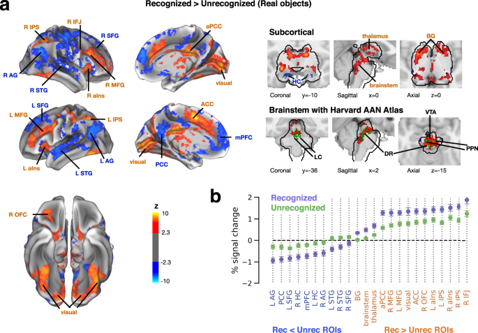 Cortical And Subcortical Signatures Of Conscious Object Recognition Nature Communications
