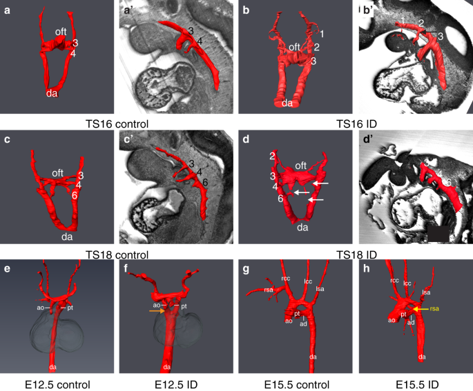 Maternal Iron Deficiency Perturbs Embryonic Cardiovascular Development In Mice Nature Communications Maternal Iron Deficiency Perturbs Embryonic Cardiovascular Development In Mice Nature Communications