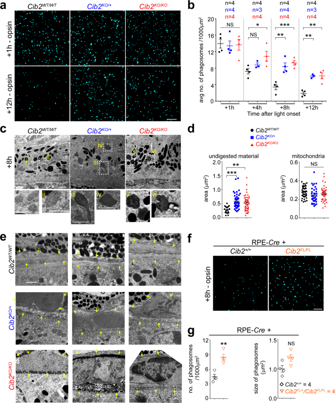Fig. 4: Deficiency of CIB2 resulted in impaired phagolysosomal processing of OS.