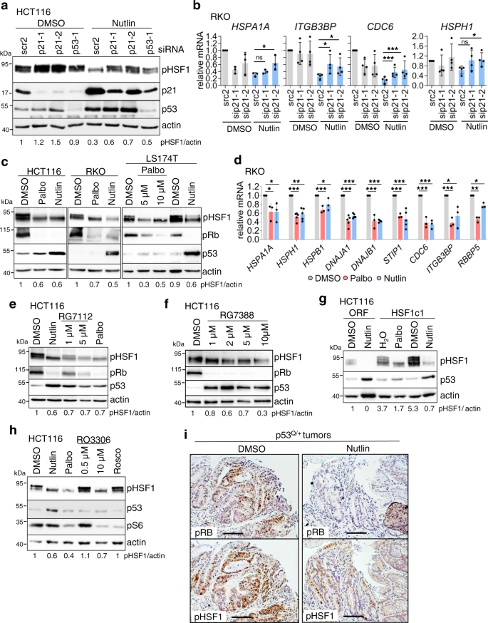 Fig. 4: p53 suppresses HSF1 activity via cyclin-dependent kinase inhibitor CDKN1A/p21 in human CRC cells.