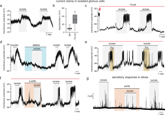 Lactate sensing mechanisms in arterial chemoreceptor cells 