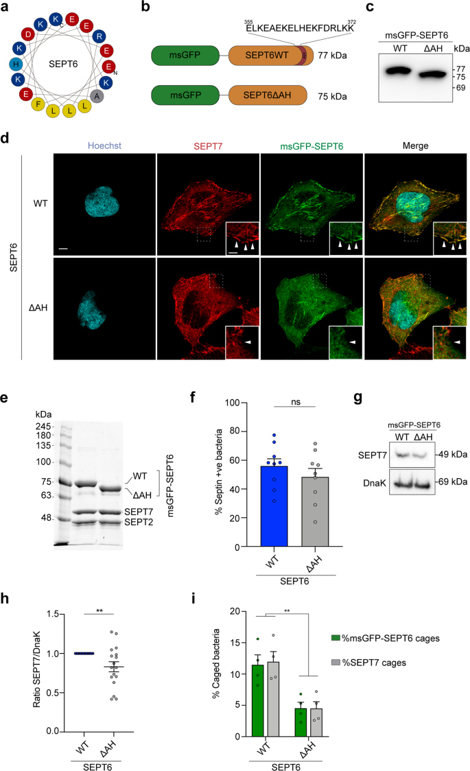 Fig. 3: A C-terminal SEPT6 amphipathic helix domain is important for membrane curvature sensing and cage entrapment.