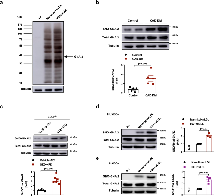 Fig. 1: S-nitrosylation of GNAI2 is significantly higher in diabetes-accelerated atherosclerosis in vitro and in vivo.