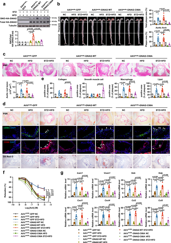 Fig. 3: Inhibition of SNO-GNAI2 at Cys66 mitigates endothelial dysfunction in diabetes-accelerated atherosclerosis.