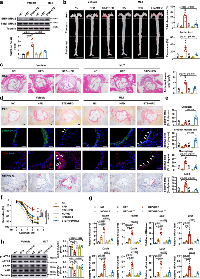 Fig. 7: Melatonin exerts anti-inflammation and athero-protective role under diabetic condition.