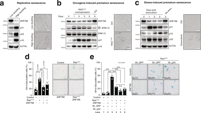 Fig. 4: ZNF768 is depleted upon senescence entry and its overexpression contributes to bypass this process.