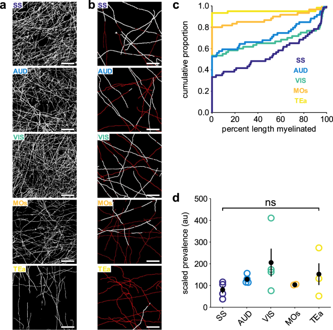Cortical Neurons Exhibit Diverse Myelination Patterns That Scale Between Mouse Brain Regions And Regenerate After Demyelination Nature Munications