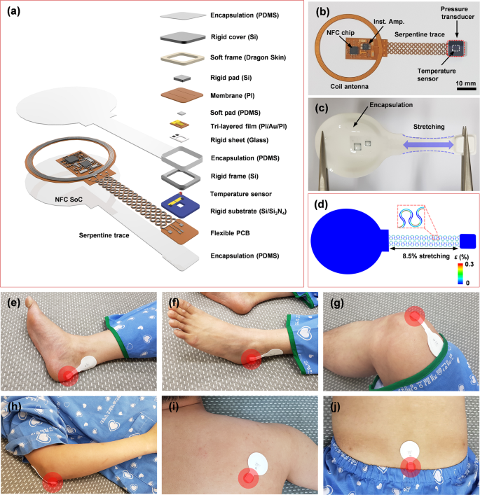 Battery-free, wireless soft sensors for continuous multi-site measurements  of pressure and temperature from patients at risk for pressure injuries |  Nature Communications