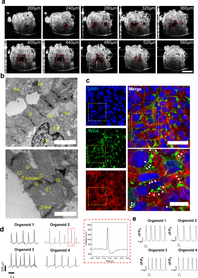 Self Assembling Human Heart Organoids For The Modeling Of Cardiac Development And Congenital Heart Disease Nature Communications