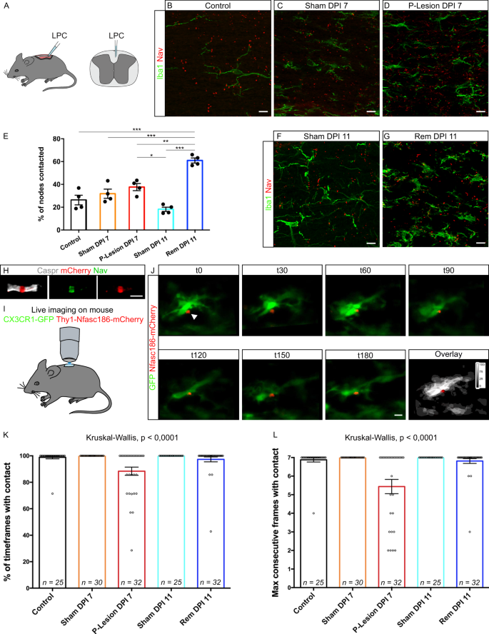 Microglia Neuron Interaction At Nodes Of Ranvier Depends On Neuronal Activity Through Potassium Release And Contributes To Remyelination Nature Communications