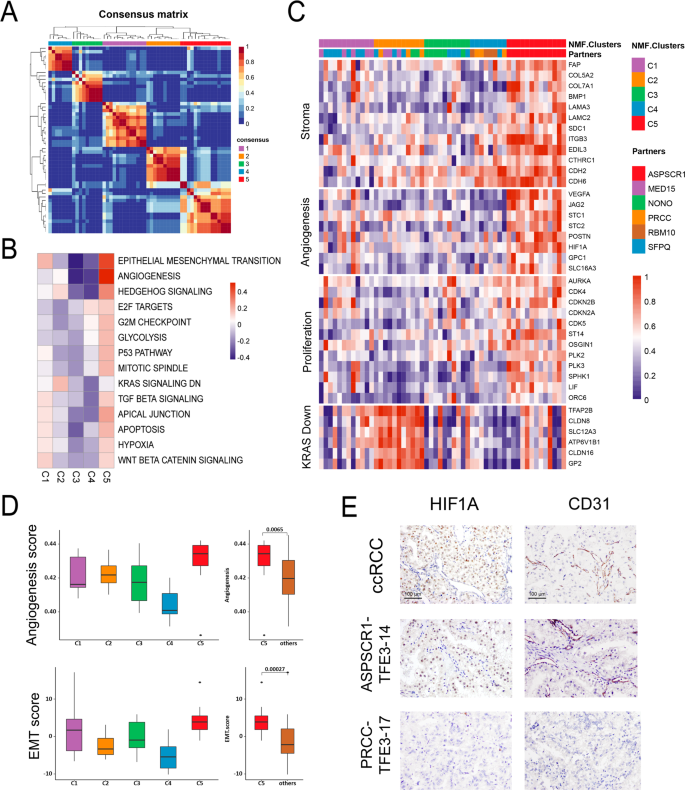Integrated Exome And Rna Sequencing Of Tfe3 Translocation Renal Cell Carcinoma Nature Communications