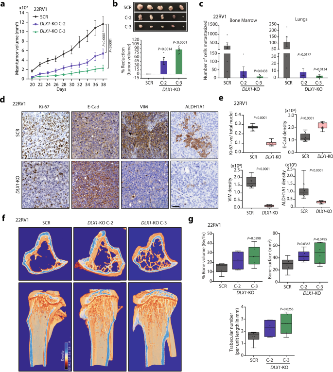 Fig. 3: Abrogating DLX1 expression results in tumor regression and reduced metastases.