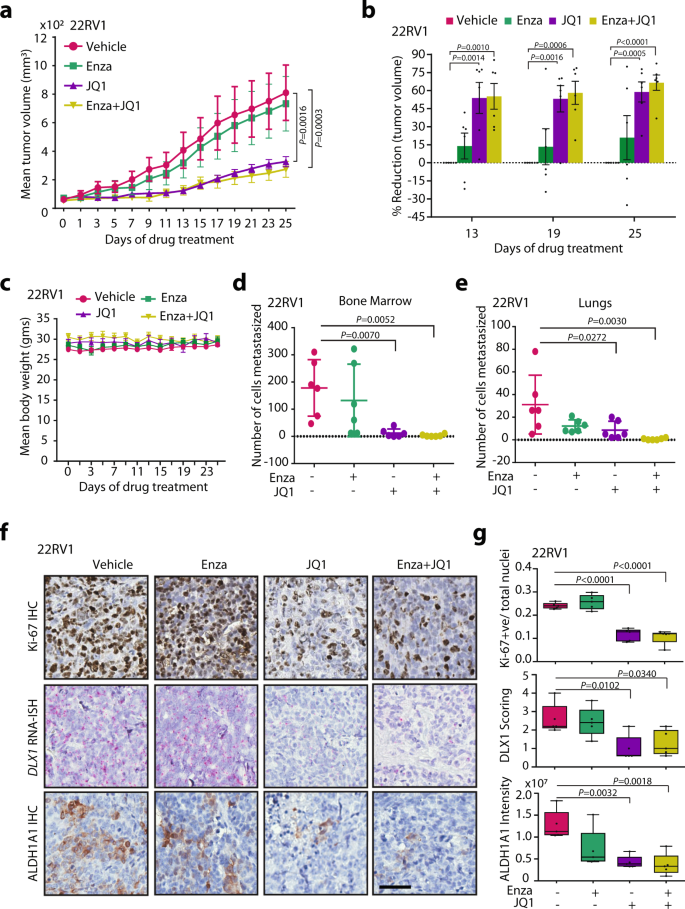 Fig. 8: BET inhibitor alone or in combination with Enzalutamide attenuates DLX1-mediated tumorigenesis and metastases.