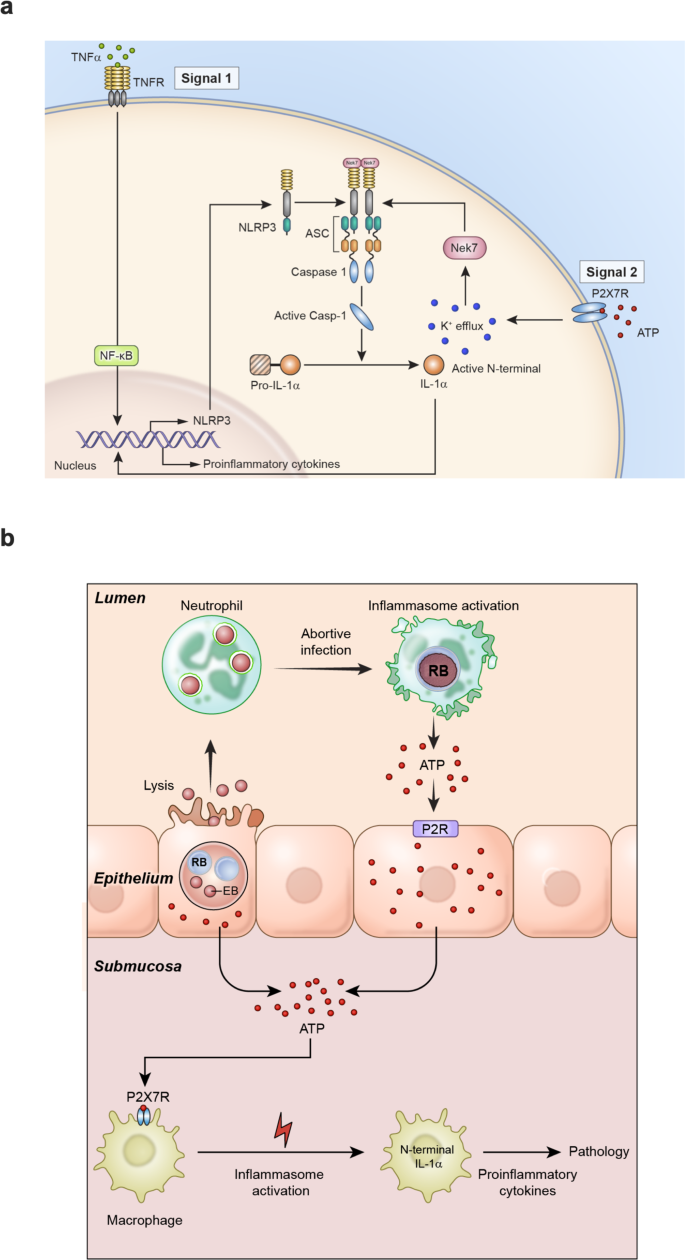 Fig. 7: A model of sterile inflammation generated by chlamydial infection of uterine epithelium.