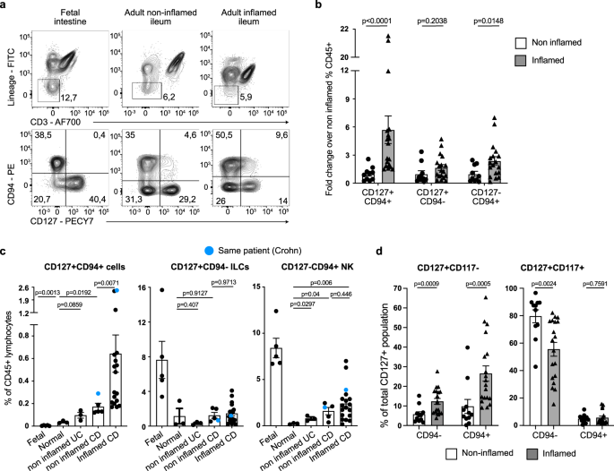 Fig. 4: Granulysin-expressing CD117− population B is expanded in inflamed intestine from Crohn’s disease patients.