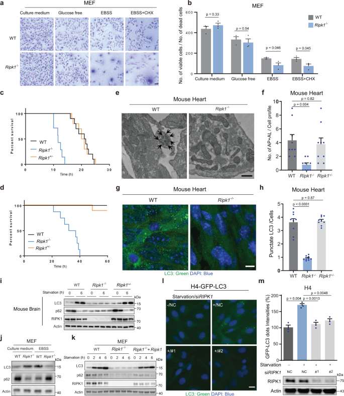 Transcriptional control of aspartate kinase expression during