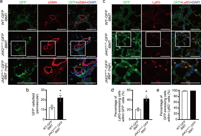 Fig. 3: Characterization of bone marrow-derived JAK2V617F hematopoietic cells in the lungs by the use of GFP-transgene.