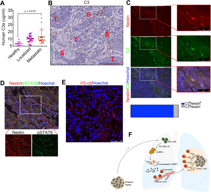 Fig. 7: High C3 expression levels are associated with metastasis in breast cancer patients.