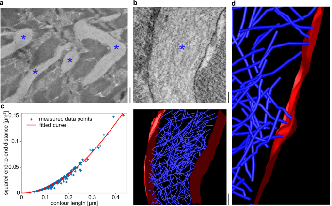 Fig. 1: Tissue deposits of FOR001 amyloid fibrils.