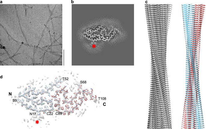 Fig. 2: Cryo-EM structure of the FOR001 AL amyloid fibril.