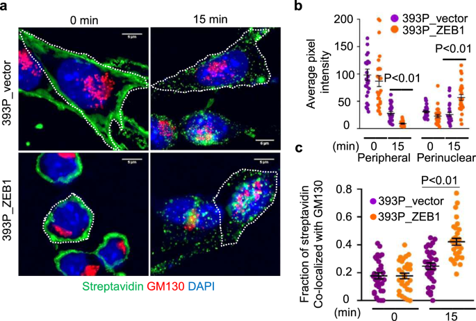 Fig. 1: ZEB1 enhances the endocytosis of PM-bound proteins.