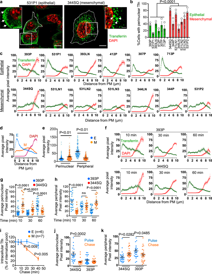 Fig. 2: Distinct transferrin (Tfn) trafficking patterns in epithelial and mesenchymal lung adenocarcinoma (LUAD) cells.