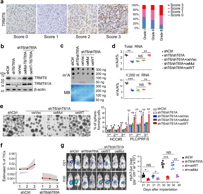 Fig. 2: TRMT6/TRMT61A-mediated m1A modification drives self-renewal of liver CSCs and tumourigenesis.