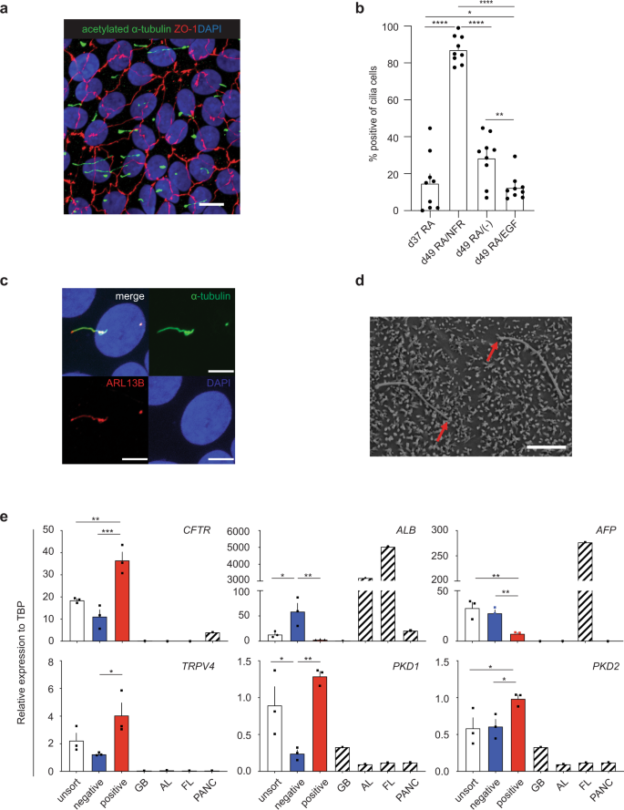 Fig. 3: DHIC5-4D9 positive cells show primary cilia, a characteristic feature of cholangiocyte.