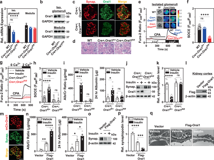 Fig. 3: Insulin activation targeting the Orai1 channel induces albuminuria in mice.