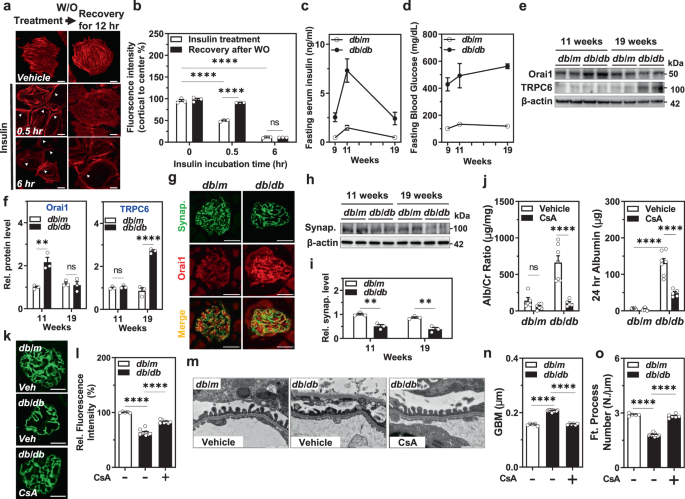 Insulin Activated Store Operated Ca2 Entry Via Orai1 Induces Podocyte Actin Remodeling And Causes Proteinuria Nature Communications