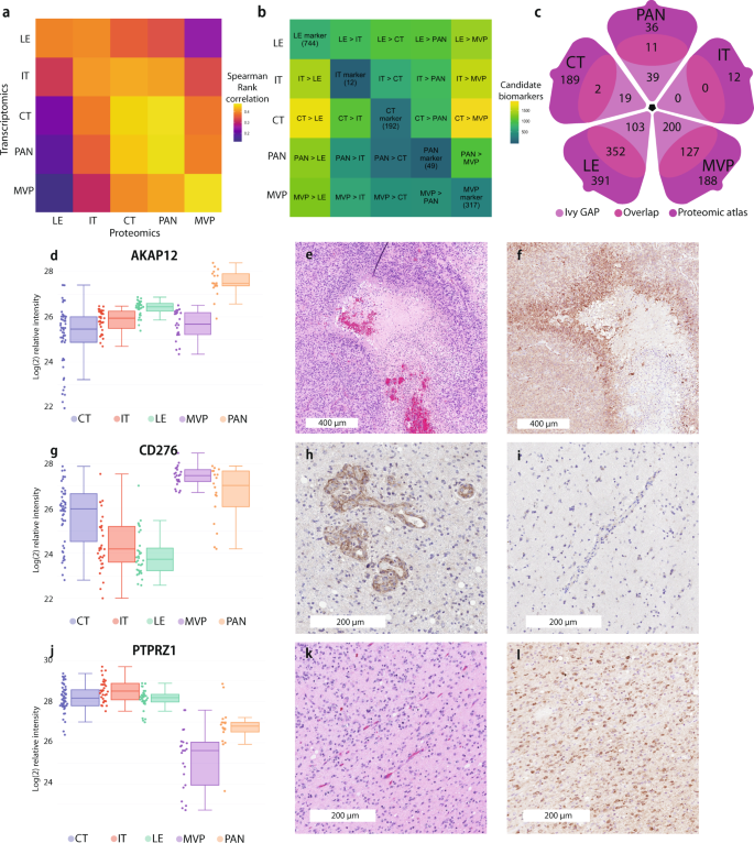 Fig. 3: Region-specific biomarker identification and validation.