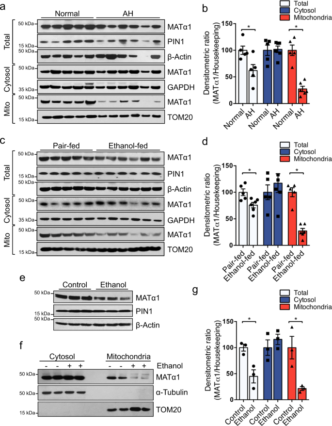 Fig. 1: Mitochondrial MATα1 level is selectively reduced in alcohol-associated liver disease.