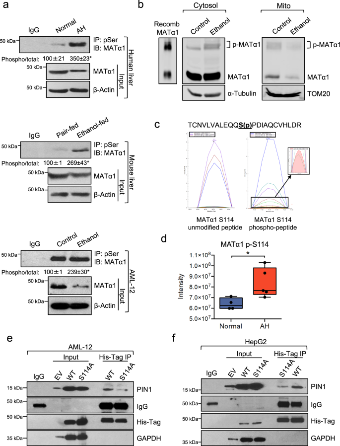 Fig. 4: Alcohol-induced MATα1 phosphorylation at Ser114 is required for PIN1 binding.
