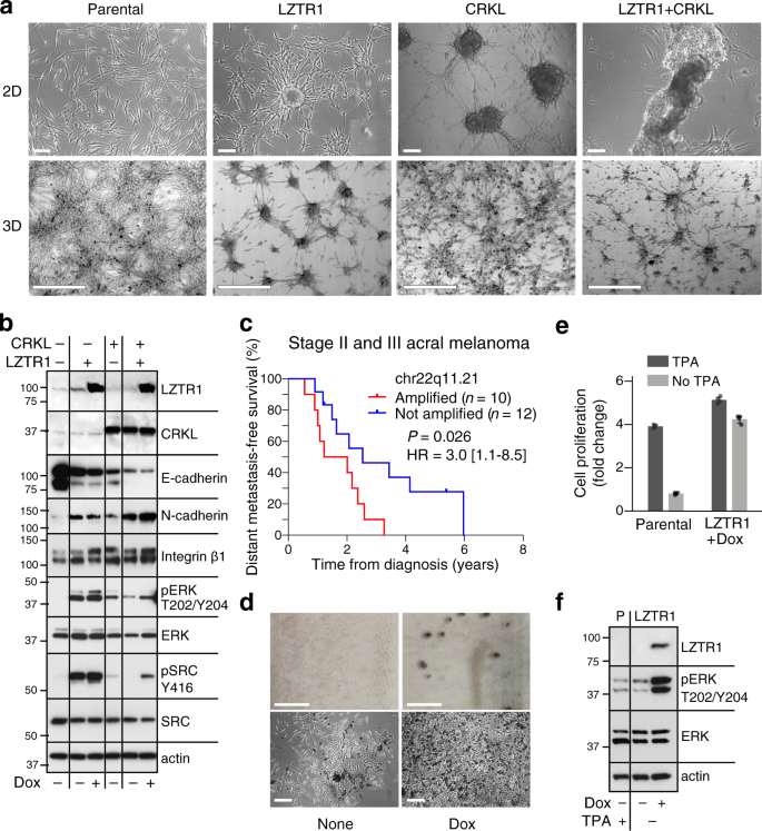 Fig. 6: Overexpression of LZTR1 and CRKL confer properties consistent with malignant cell transformation and metastasis initiation.