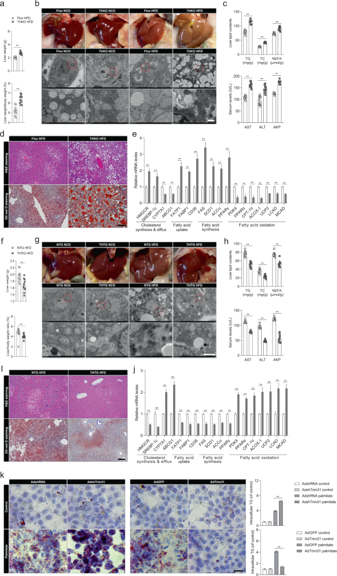 Fig. 3: Functional loss of hepatic Trim31 aggravates HFD-induced hepatic steatosis.