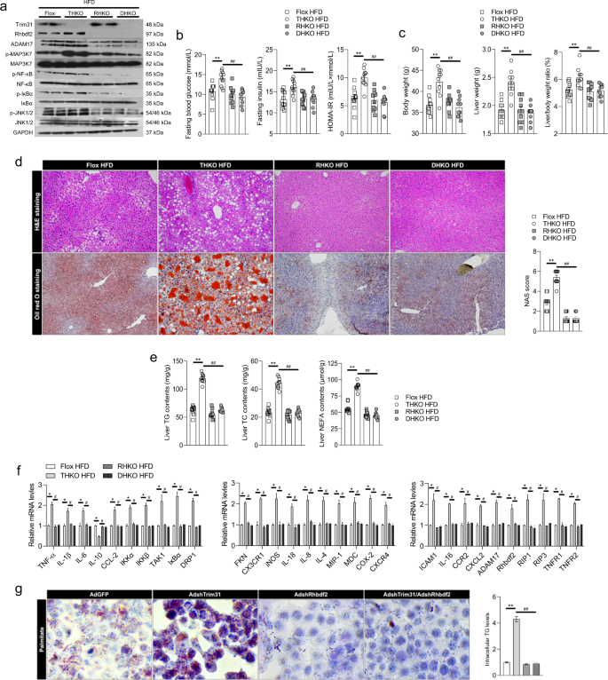 Fig. 7: Rhbdf2 signaling is obbligato for the protective effect of Trim31 on suppression of liver steatosis and inflammation.