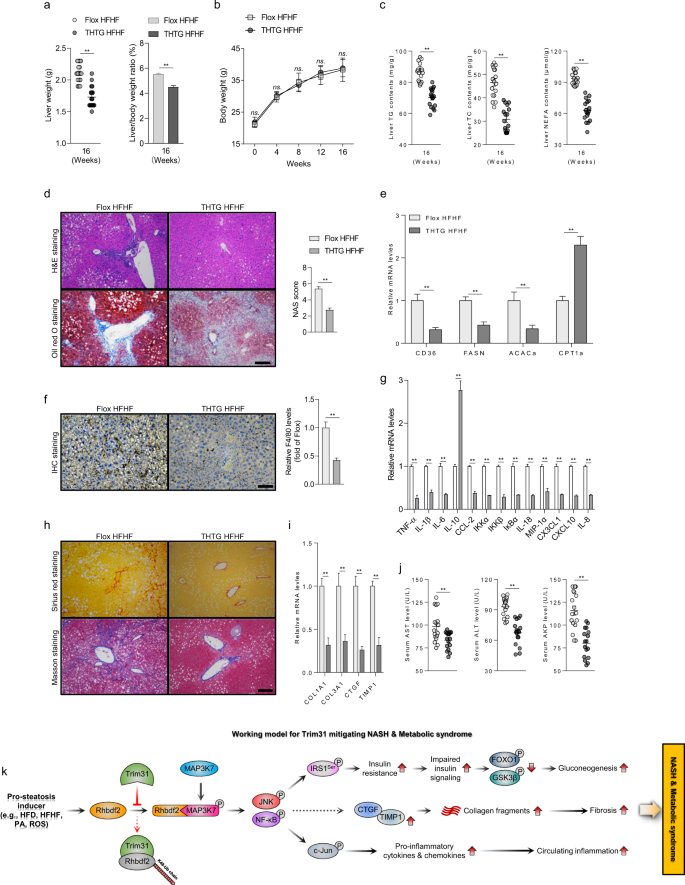 Fig. 8: Therapeutic effects of Trim31 on HFHF-induced nonalcoholic steatohepatitis (NASH) in vivo.