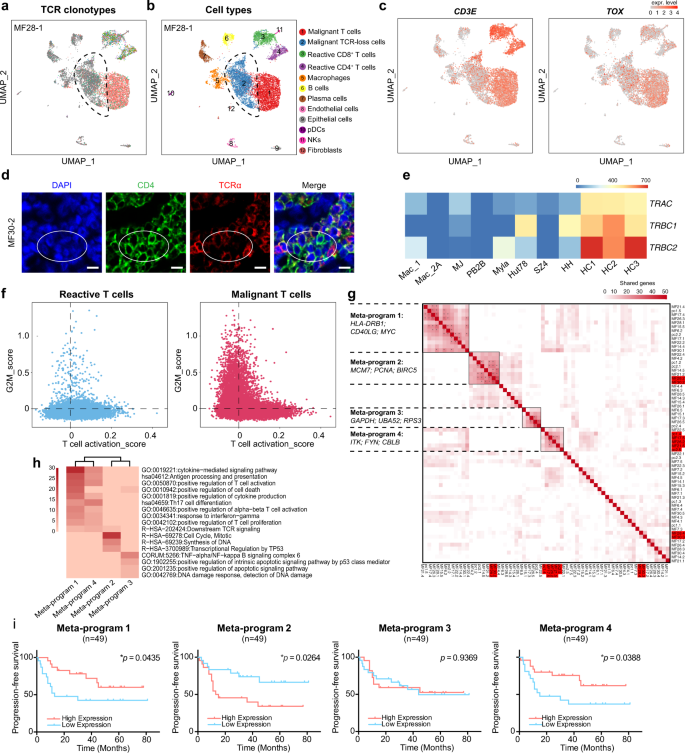 Fig. 2: Malignant T cells displayed highly diversified transcriptional profiles.