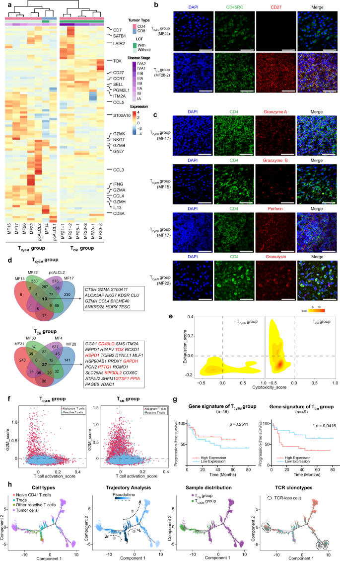 Fig. 4: A molecular subtyping scheme for CTCL based on the transcriptomes of malignant T cells.