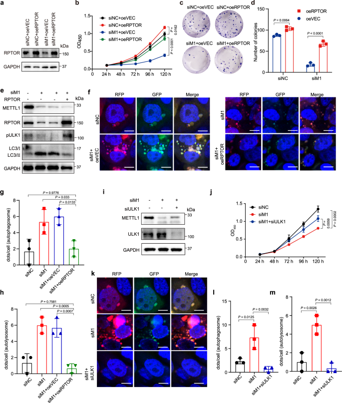 N7-methylguanosine tRNA modification promotes esophageal squamous cell  carcinoma tumorigenesis via the RPTOR/ULK1/autophagy axis | Nature  Communications