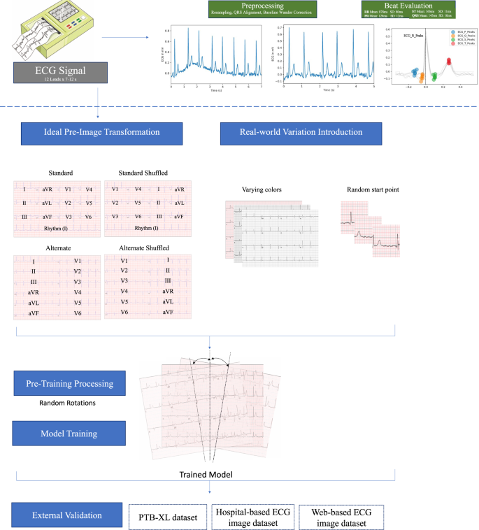 Fig. 1: Study outline for waveform preprocessing and image transformation for modeling.