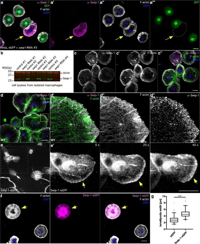 Fig. 1: Swip-1 localizes to protruding lamellipodia.