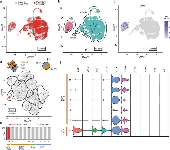 Fig. 5: Analysis of scRNAseq data of bronchoalveolar lavage (BAL).