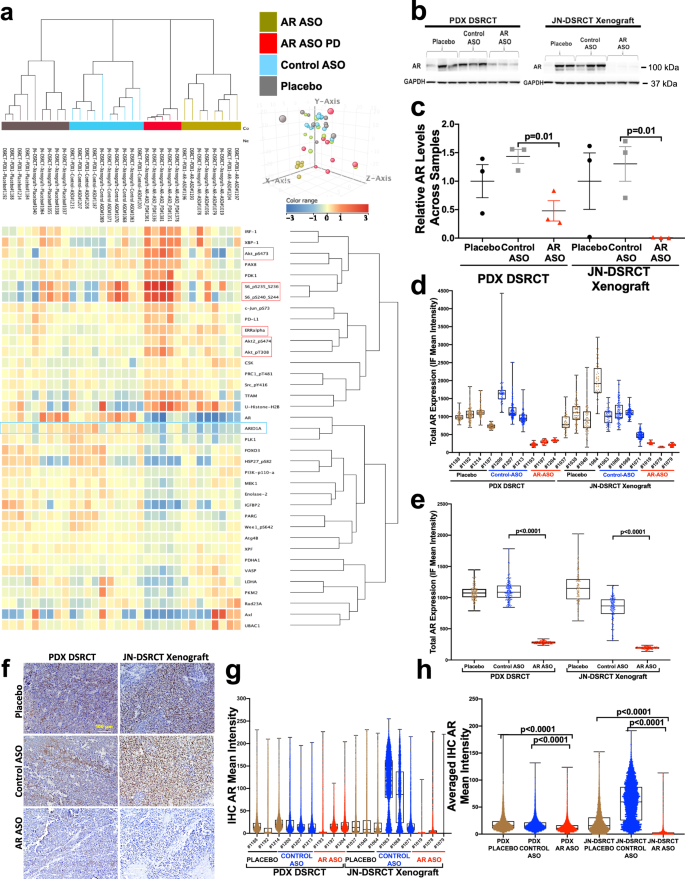 Fig. 6: Proteomic evaluation of AR expression in JN-DSRCT and PDX tumors after AR-based antisense therapy.