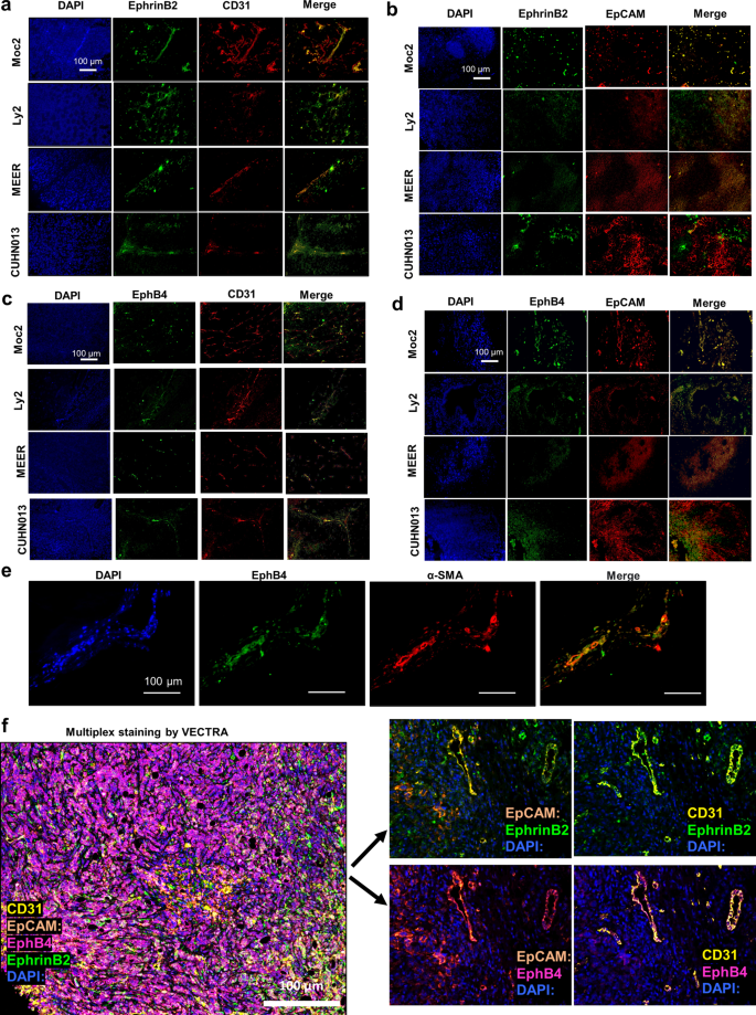 Fig. 1: Variable expression of EphB4 and ephrinB2 is found on HNSCC tumor cells and within the TME across different tumor models.